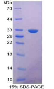 Figure 1. SDS-PAGE