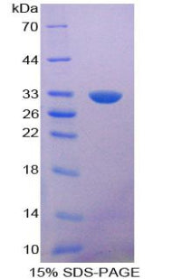 Figure 1. SDS-PAGE