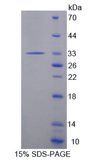 Figure 1. SDS-PAGE
