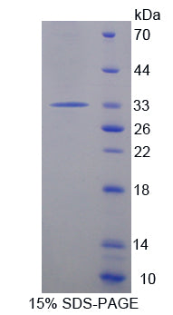 Figure 1. SDS-PAGE