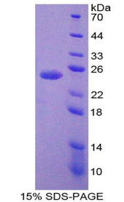Figure 1. SDS-PAGE
