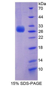 Figure 1. SDS-PAGE