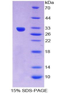 Figure 1. SDS-PAGE