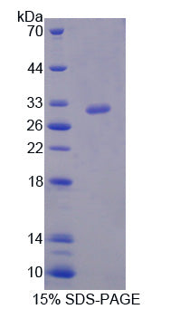 Figure 1. SDS-PAGE