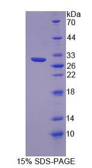 Figure 1. SDS-PAGE