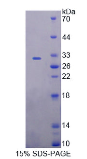 Figure 1. SDS-PAGE