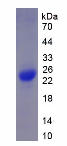 Figure 1. SDS-PAGE