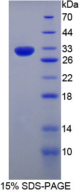 Figure 1. SDS-PAGE