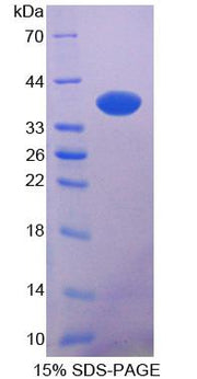 Figure 1. SDS-PAGE