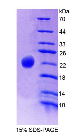 Figure 1. SDS-PAGE