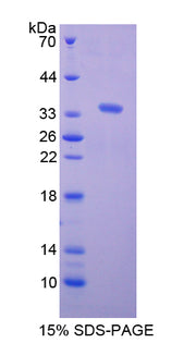 Figure 1. SDS-PAGE
