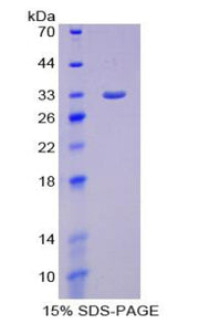Figure 1. SDS-PAGE