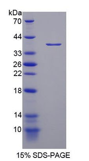 Figure 1. SDS-PAGE