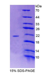 Figure 1. SDS-PAGE