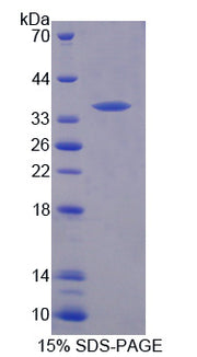 Figure 1. SDS-PAGE