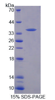 Figure 1. SDS-PAGE