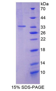 Figure 1. SDS-PAGE
