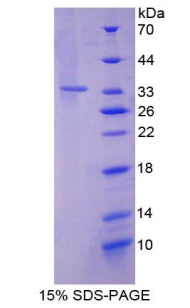 Figure 1. SDS-PAGE