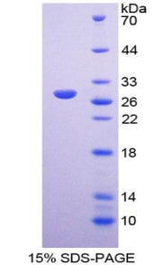 Figure 1. SDS-PAGE