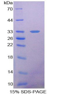 Figure 1. SDS-PAGE