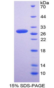 Figure 1. SDS-PAGE