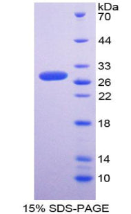 Figure 1. SDS-PAGE