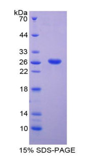 Figure 1. SDS-PAGE