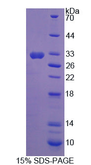 Figure 1. SDS-PAGE