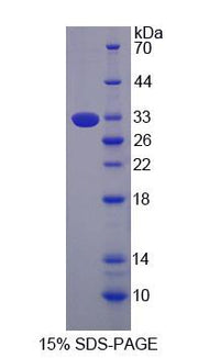 Figure 1. SDS-PAGE