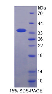 Figure 1. SDS-PAGE