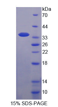 Figure 1. SDS-PAGE