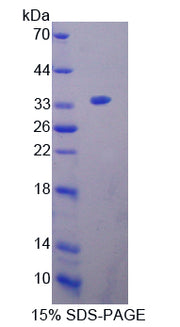 Figure 1. SDS-PAGE