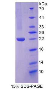 Figure 1. SDS-PAGE