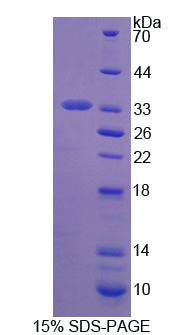Figure 1. SDS-PAGE