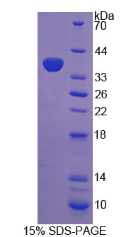 Figure 1. SDS-PAGE