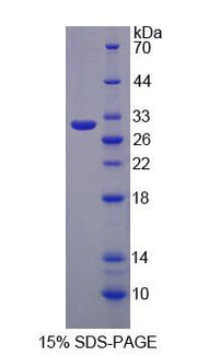 Figure 1. SDS-PAGE