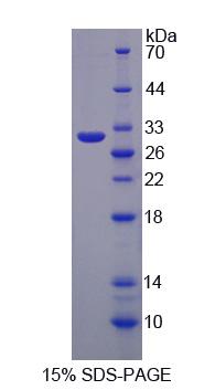 Figure 1. SDS-PAGE