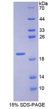 Figure 1. SDS-PAGE