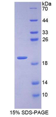 Figure 1. SDS-PAGE