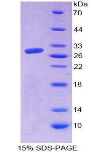 Figure 1. SDS-PAGE