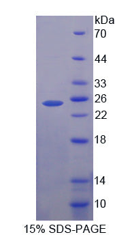 Figure 1. SDS-PAGE
