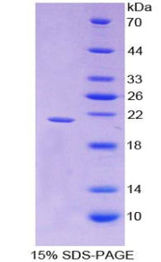 Figure 1. SDS-PAGE