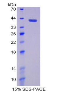 Figure 1. SDS-PAGE
