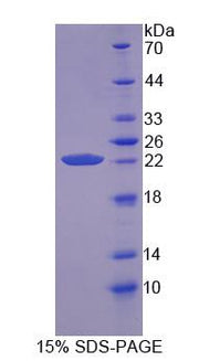 Figure 1. SDS-PAGE