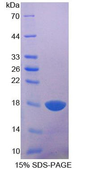 Figure 1. SDS-PAGE
