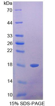 Figure 1. SDS-PAGE