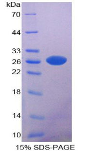 Figure 1. SDS-PAGE