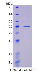 Figure 1. SDS-PAGE