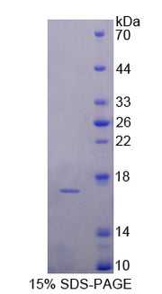 Figure 1. SDS-PAGE