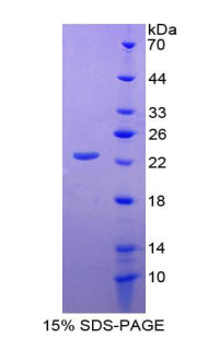 Figure 2. SDS-PAGE